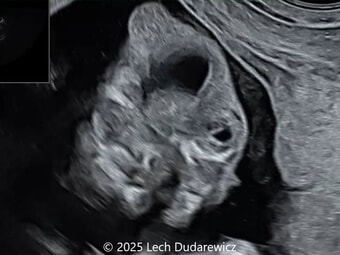 Case of the Week #638