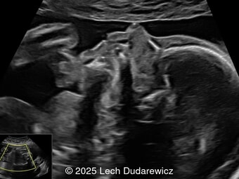 Case of the Week #640