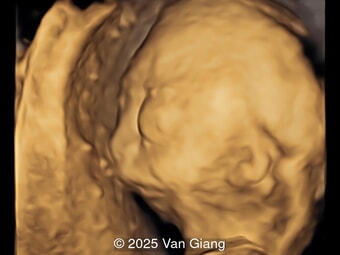 Case of the Week #641