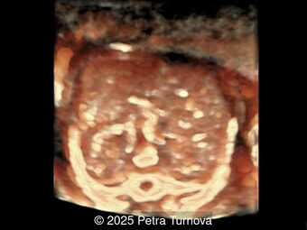 Case of the Week #647