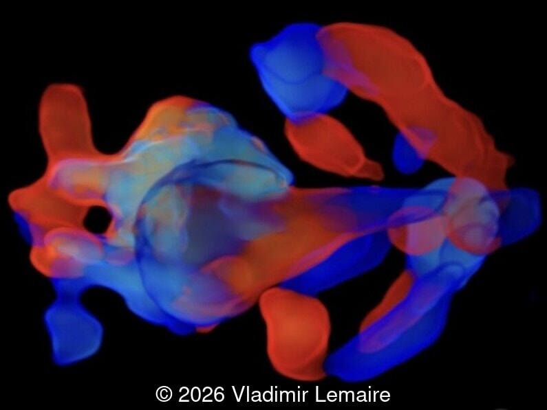 Intracranial arteries and veins in 3D color Doppler in combination with silhouette mode.
