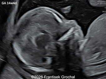 Case of the Week #648