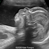 Case of the Week # 655 