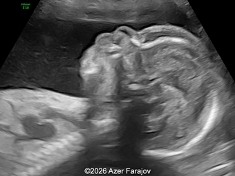 Case of the Week # 655 