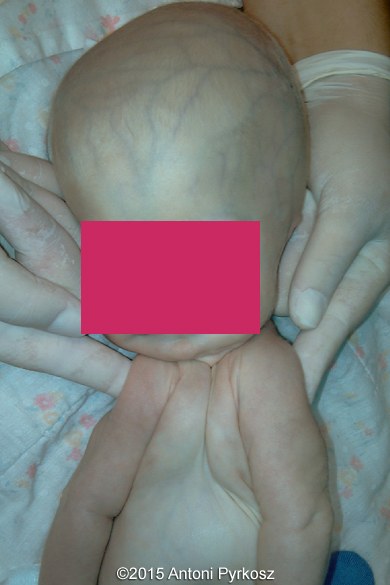 postnatal01