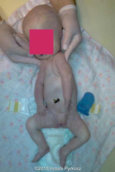 postnatal02