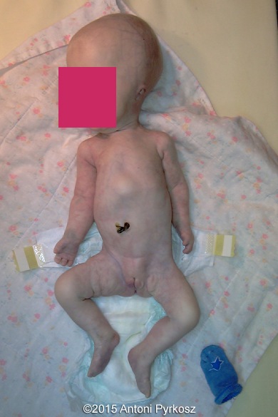 postnatal03