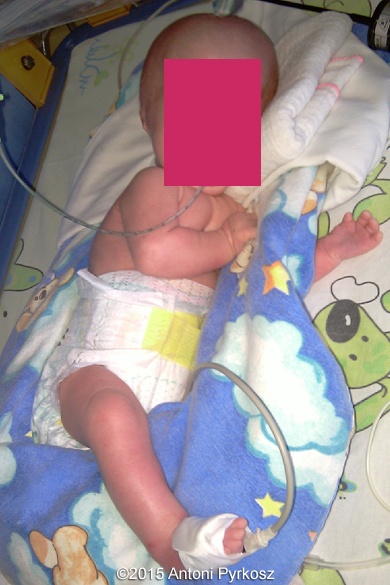 postnatal05