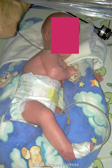 postnatal06
