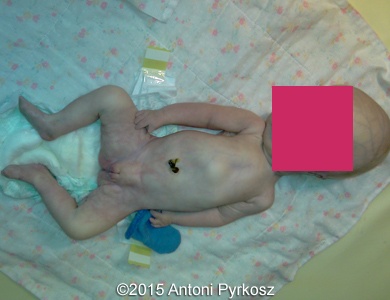 postnatal07