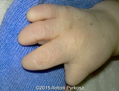 postnatal10