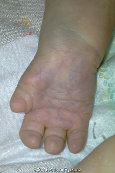 postnatal11