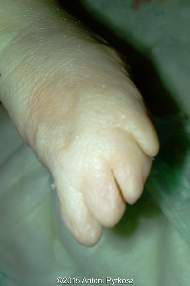 postnatal12