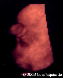 probo2