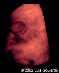 probo3