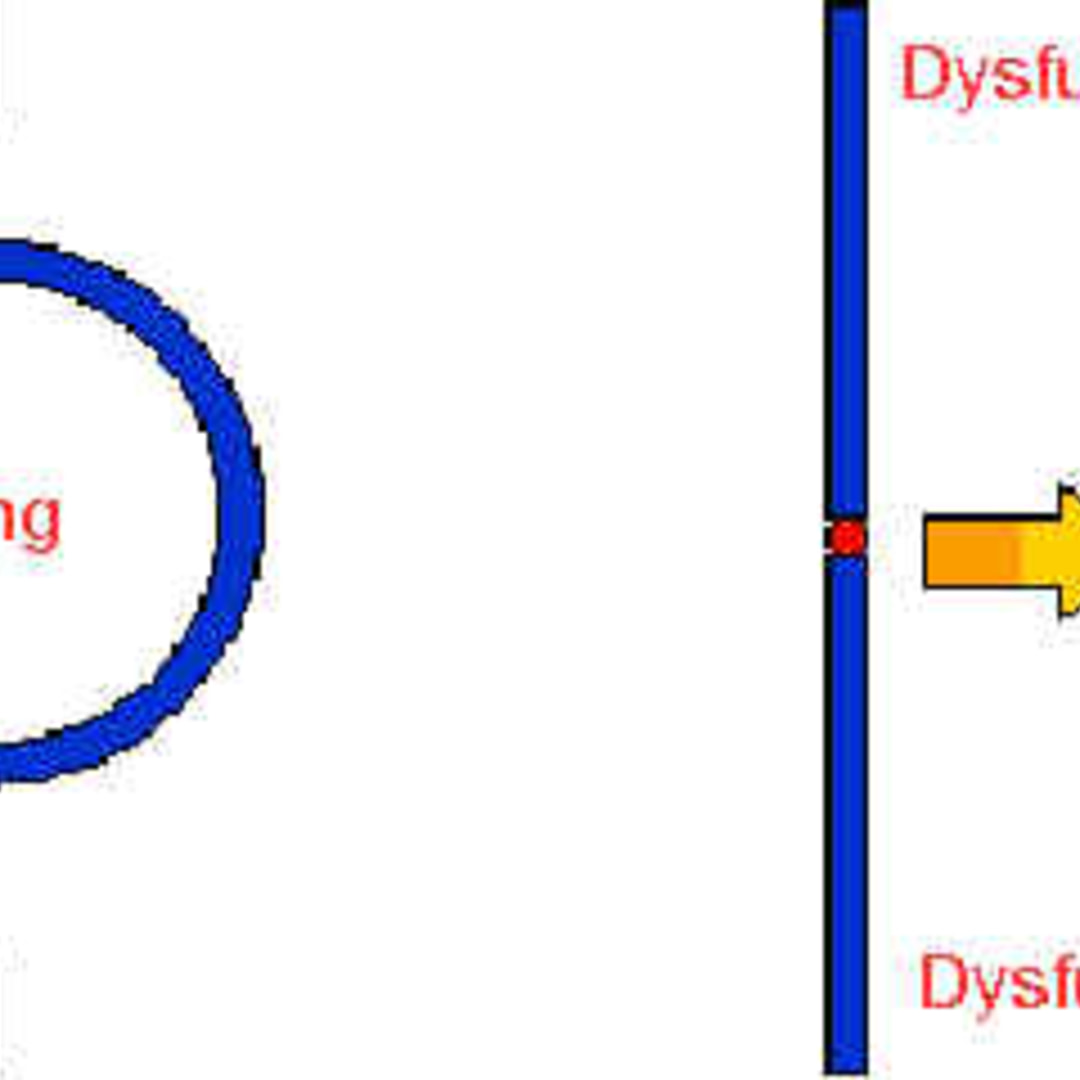  Ring Chromosome 14