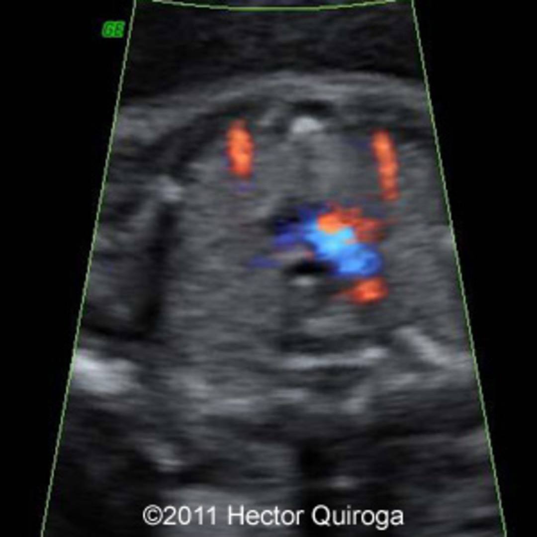 📃 Imaging of the thymus